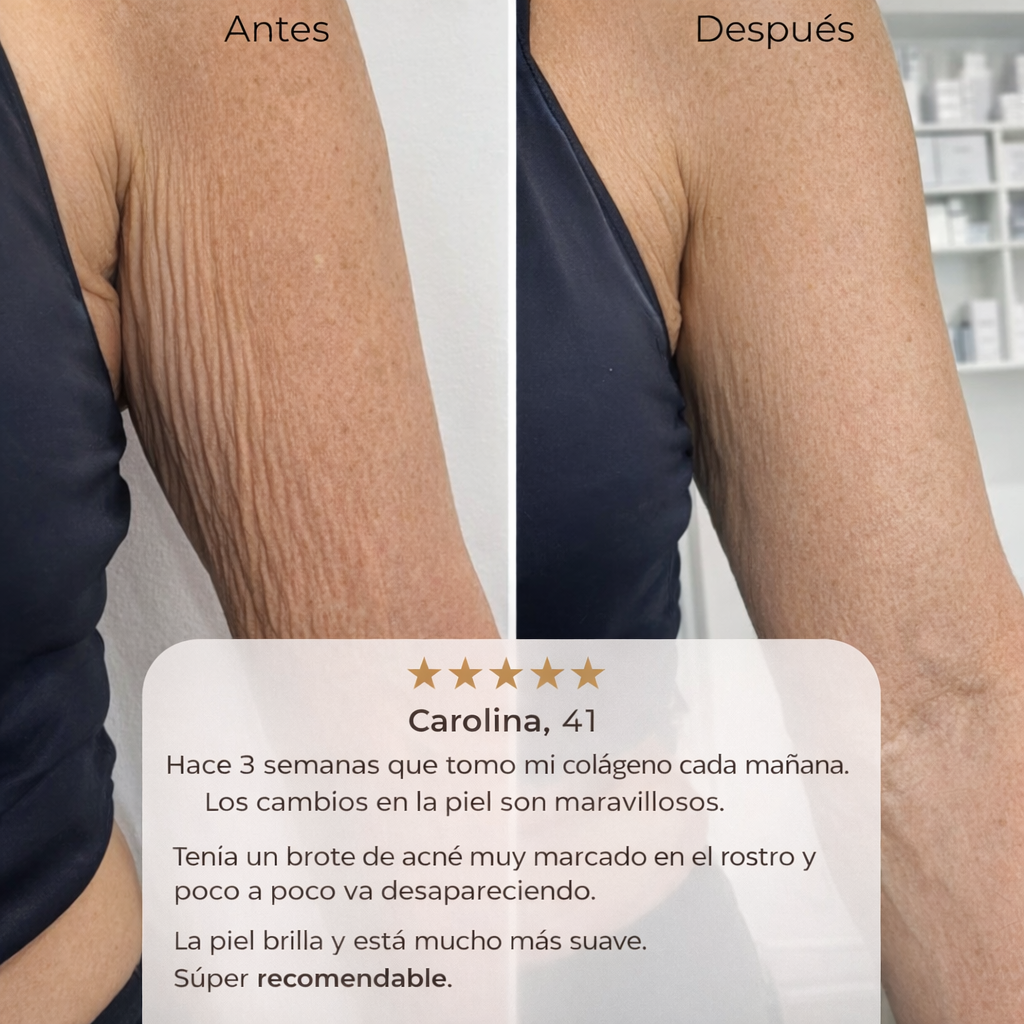 Colágeno Hidrolizado Antiage | 3 Cuotas Sin Interés